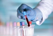 Gloved hand holding a test tube with blood.