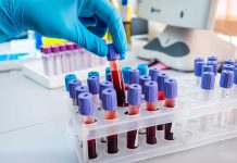 Gloved hand handling blood samples in a laboratory.